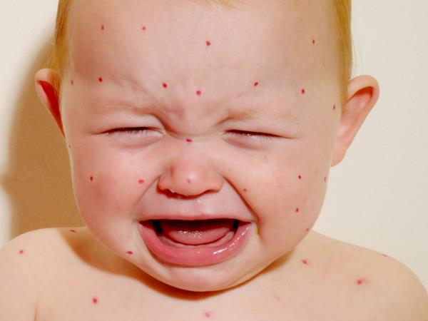 Kako učinkovita so obvezna cepiva?