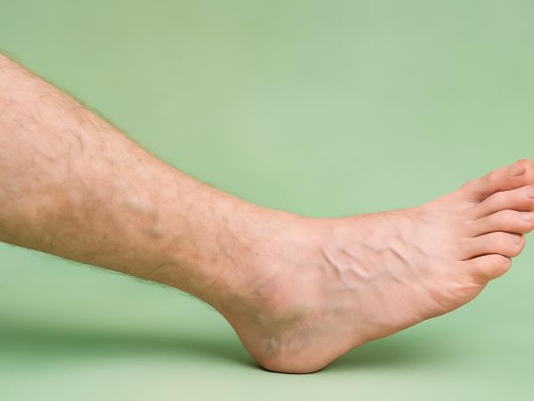 Hrana proti kr&#269;nim &#382;ilam