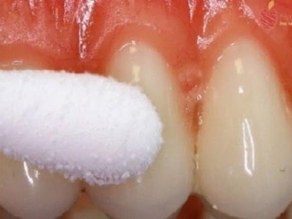 Ste že poskusili dati malo soli in popra na zobe?