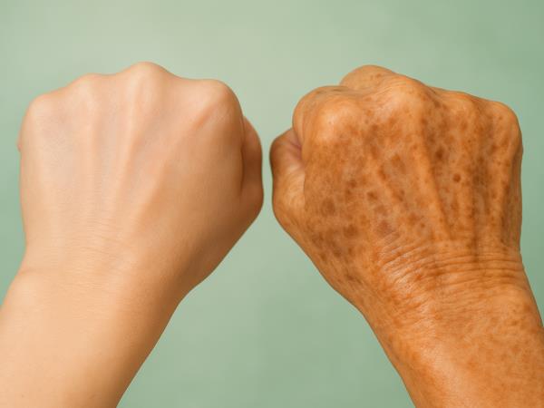 Trik, kako zbrisati starostne pege