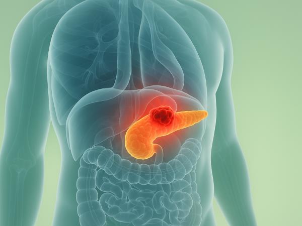 Kaj se dogaja z rakom trebušne slinavke