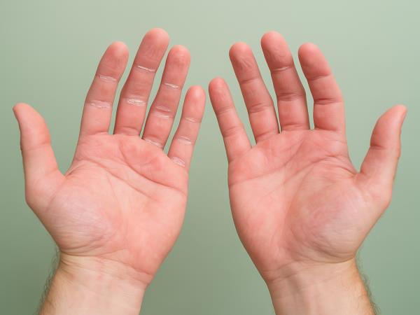 Kako na rokah prepoznati raka