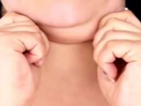 8 vaj, kako se znebiti podbradka