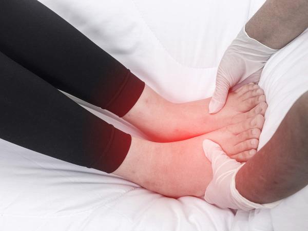 Kaj pomenijo otekle noge?