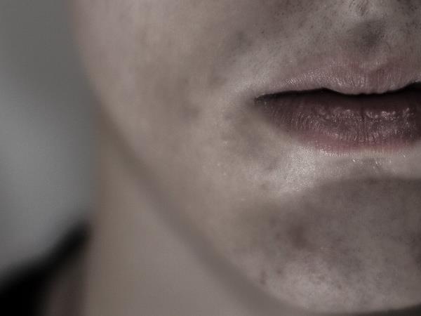 Prinaša pembrolizumab novo upanje za bolnike z rakom?