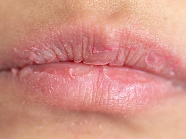 Kaj odtis ustnic pove o vas