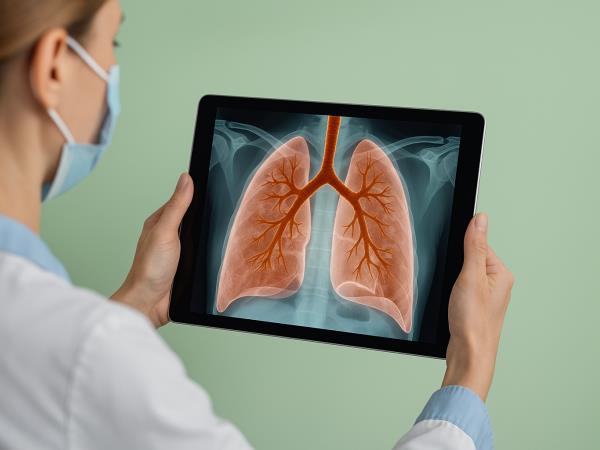 Kako lahko enostavno razkrijemo zgodnje znake pljučnega raka