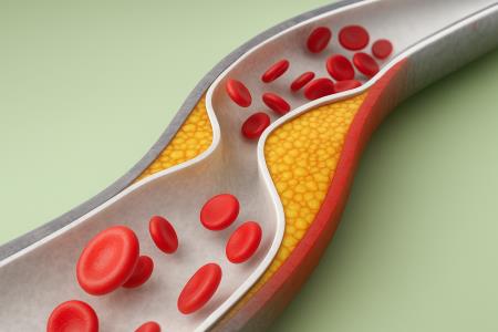 Kako na naraven način znižati holesterol