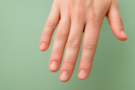 Ali veste, kateri so prvi simptomi raka, ki se najprej kažejo na rokah?